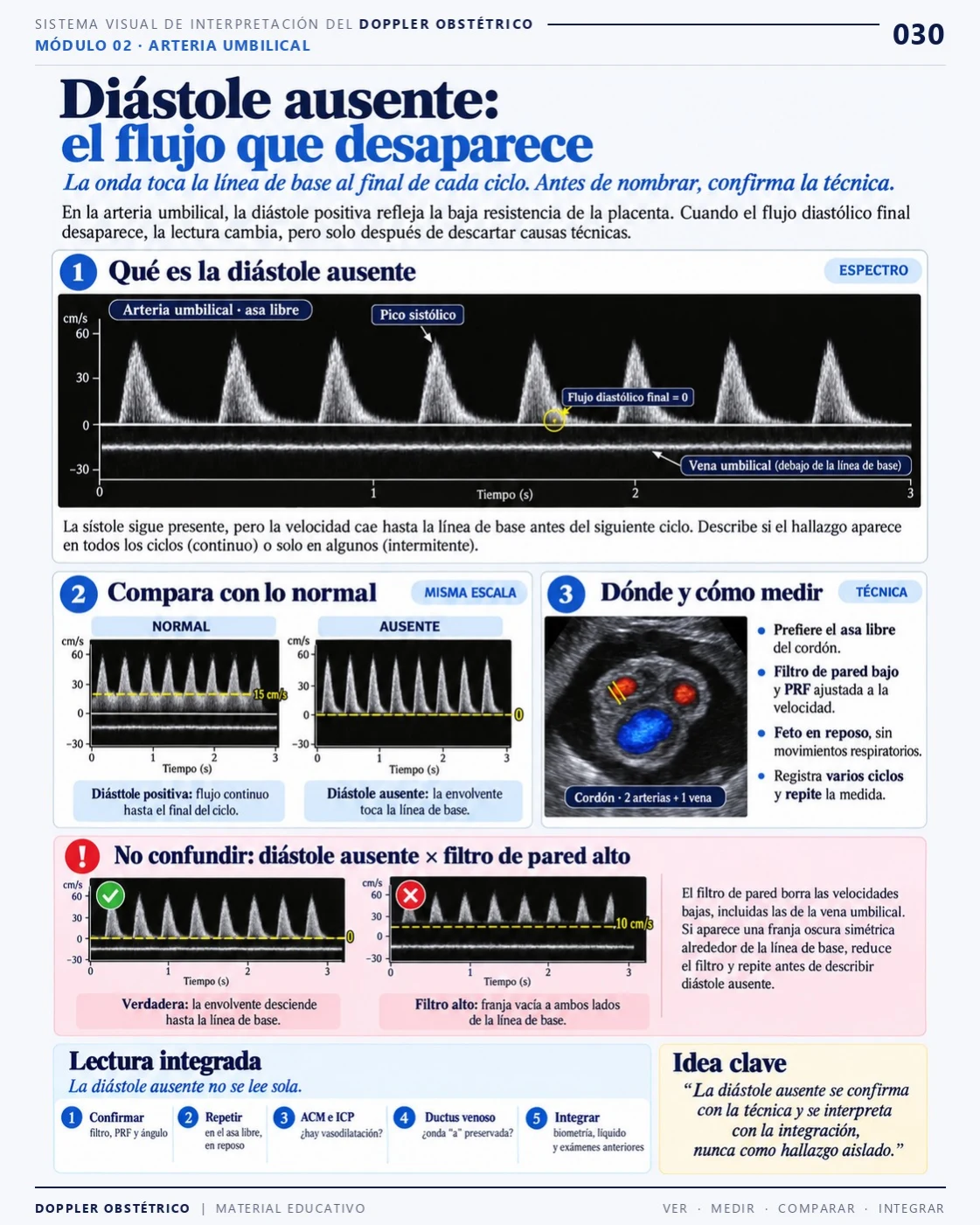 Página 30: Diástole ausente: el flujo que desaparece. Extracto del PDF de Doppler Obstétrico y Fetal.