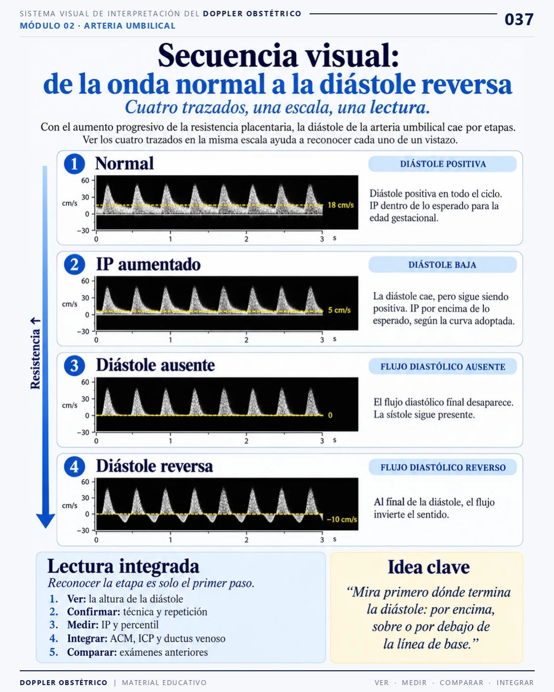 Página 37: secuencia visual de la onda normal a la diástole reversa